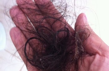 E se você se sentisse bonita mesmo estando careca? – Quando os cabelos começaram a cair depois da quimiorapia…