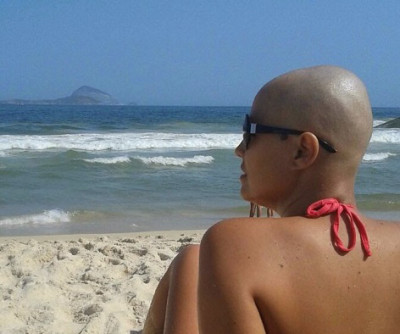 carcinoma-cancerdemama-quimioterapia-diagnostico-mamografia-mastectomia-semcabelo-careca-tratamento-dascoisasquetenhoaprendido-1