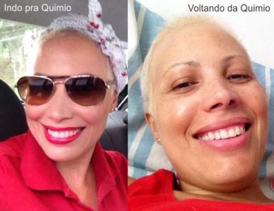 Dicas-de Make-efeito-colateral-careca-semcabelo-quimioterapia-beleza-maquiagem-cancerdemama-dascoisasquetenhoaprendido