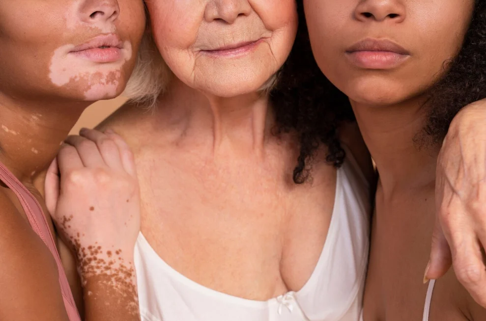 diferentes tipos de pele e o câncer