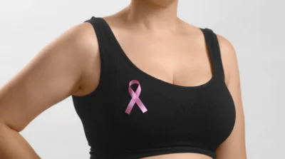 imagem-ilustrativa-paciente-de-cancer-de-mama-em-tratamento-com-tamoxifeno